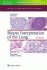 Biopsy Interpretation of the Lung. Edition Second