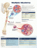 Multiple Myeloma Anatomical Chart. Edition First