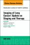 Lung Cancer, An Issue of Radiologic Clinics of North America