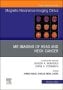 MR Imaging of Head and Neck Cancer, An Issue of Magnetic Resonance Imaging Clinics of North America