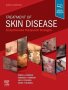 Treatment of Skin Disease. Edition: 6