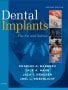 Dental Implants. Edition: 2