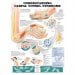 Understanding Carpal Tunnel Syndrome Chart (Flexible Laminated Poster) ISBN 9781587793219