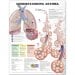 Understanding Asthma Anatomical Chart 2nd Edition - Laminated Anatomical Chart Company ISBN 9781587799389