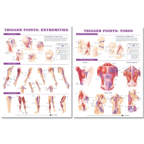 Trigger Point Chart Set 2nd Edition: Torso and Extremities - Laminated ISBN 9780781773072