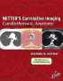 Netter's Correlative Imaging: Cardiothoracic Anatomy