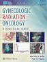 Gynecologic Radiation Oncology: A Practical Guide