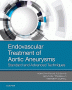 Endovascular Treatment of Aortic Aneurysms