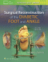 Surgical Reconstruction of the Diabetic Foot and Ankle. Edition Second