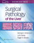 Surgical Pathology of the Liver. Edition First