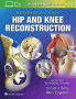 Illustrated Tips and Tricks in Hip and Knee Reconstructive and Replacement Surgery. Edition First