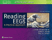 Reading EEGs: A Practical Approach. Edition Second