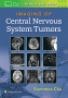 Imaging of Central Nervous System Tumors. Edition First