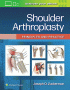 Shoulder Arthroplasty. Edition First