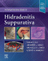 A Comprehensive Guide to Hidradenitis Suppurativa